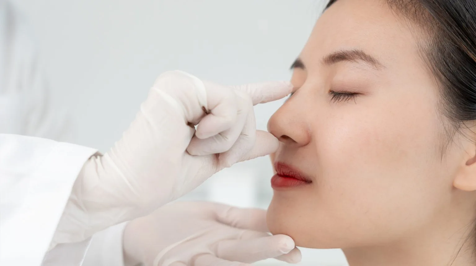 Nose Thread Lift