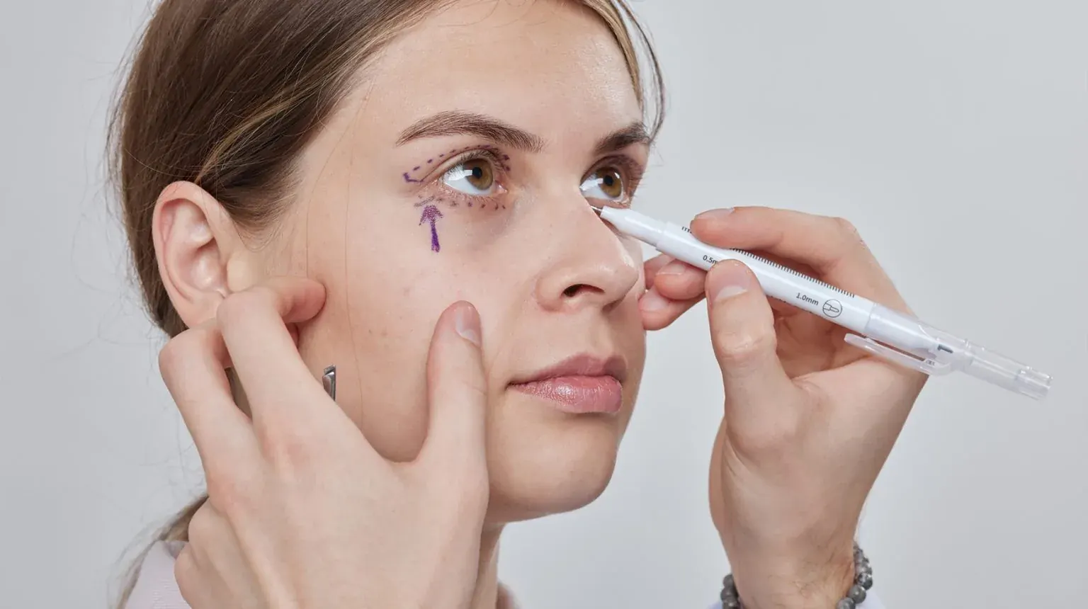 Nano Double Eyelid Thread