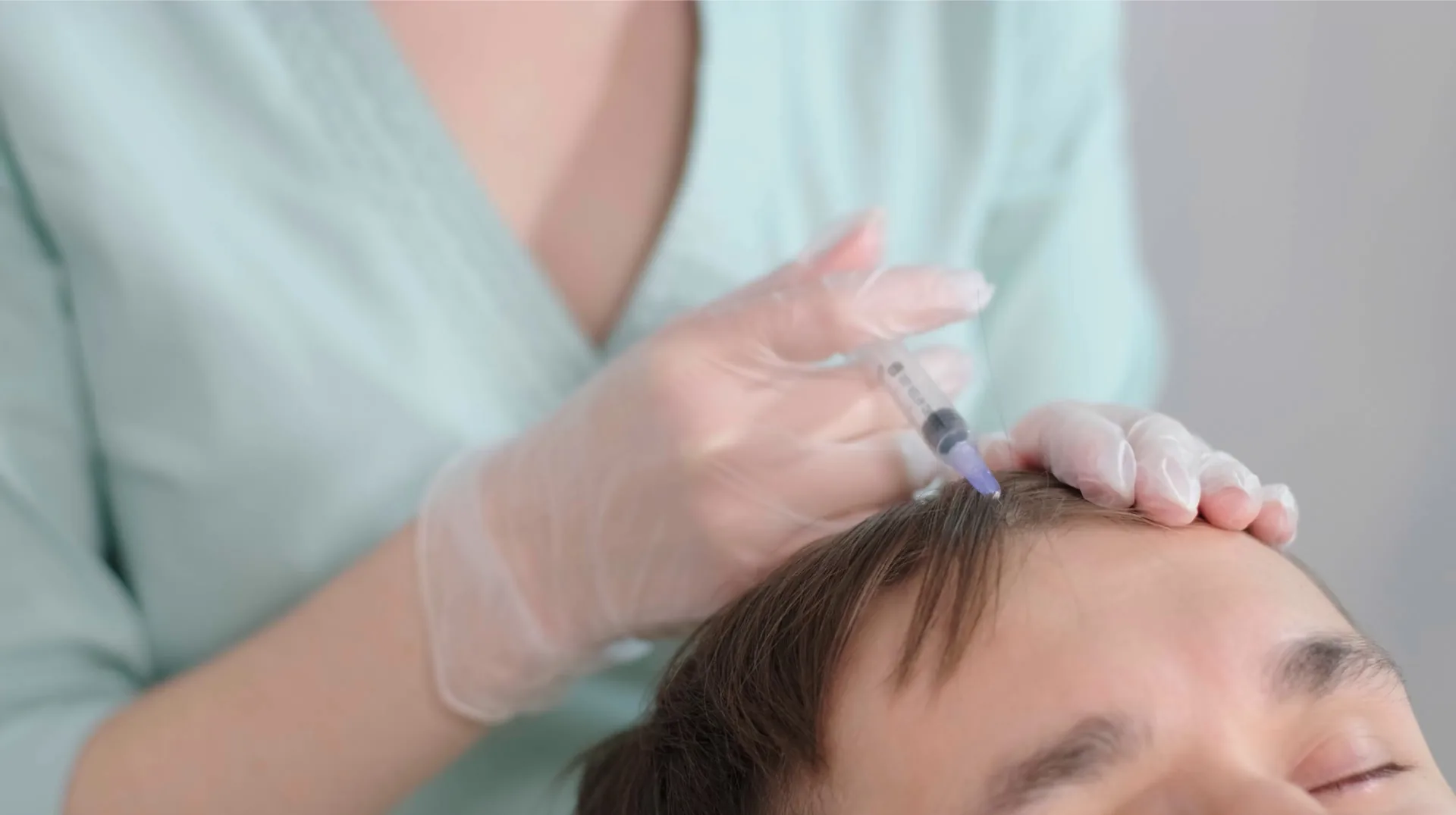 Hair Treatments at Ann Aesthetic Clinic