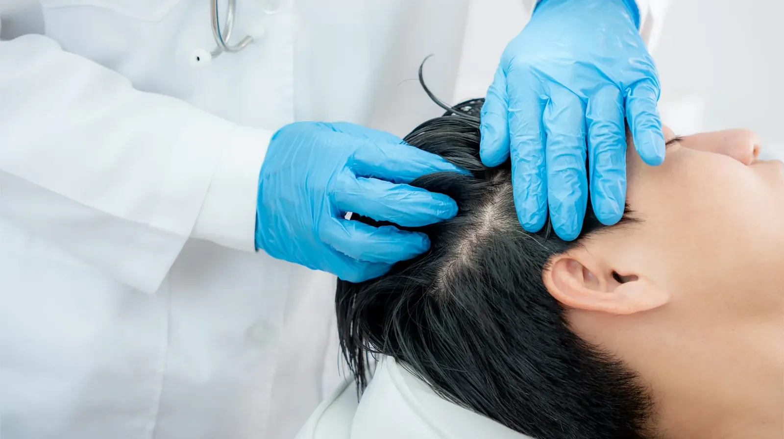 Hair Stem Cell